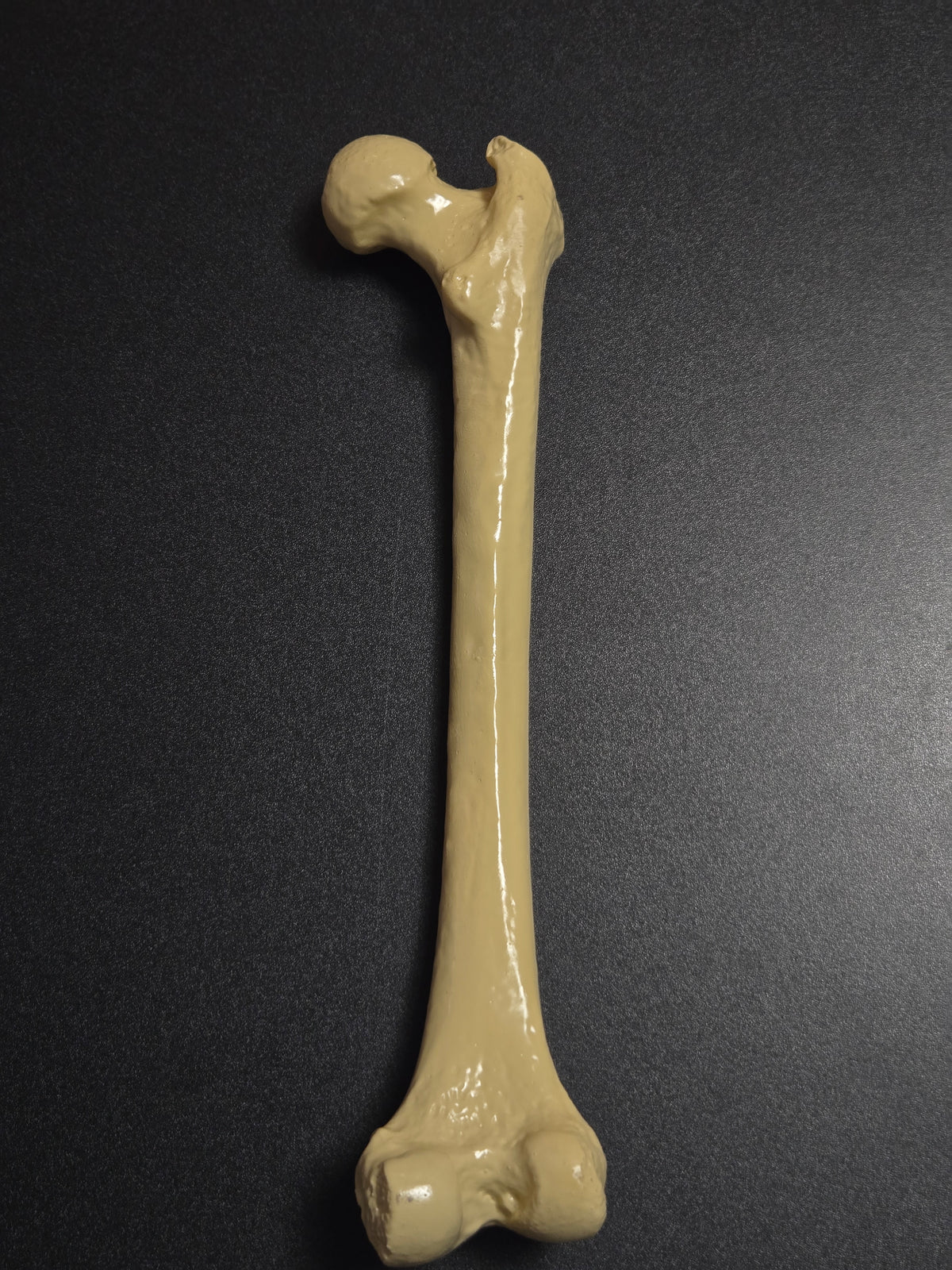 Femur