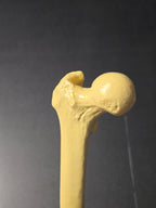 Femur