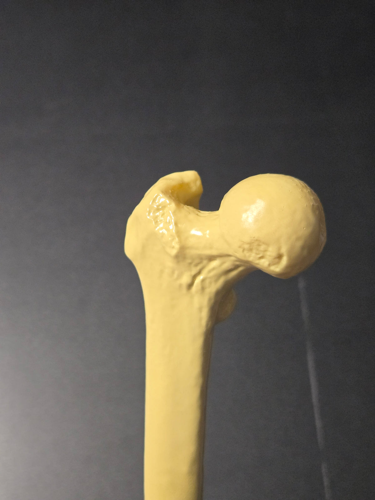 Femur