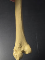 Femur